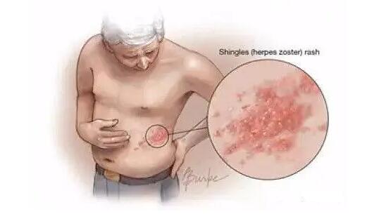 生蛇皮肤病是怎样引起的？