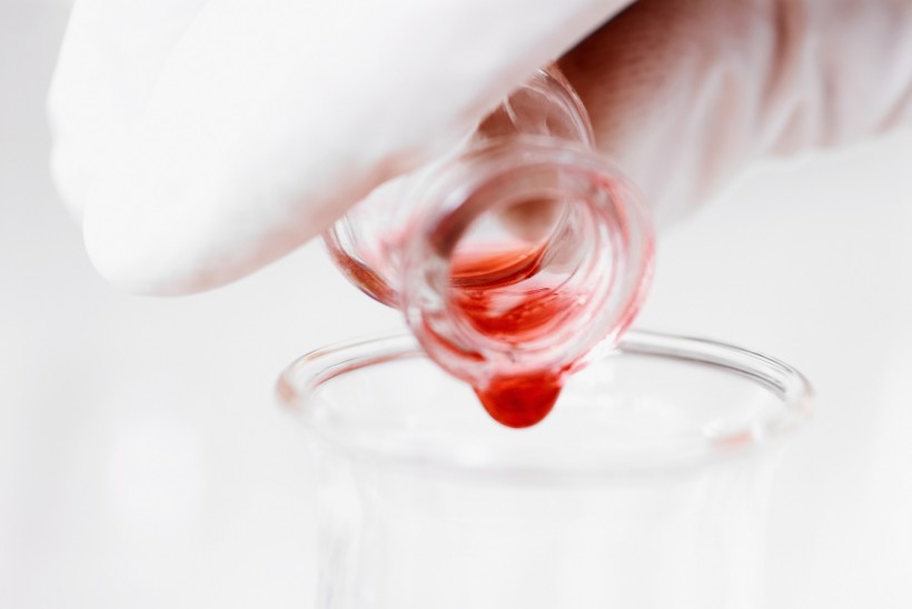 如何早期发现及预防卵巢癌？