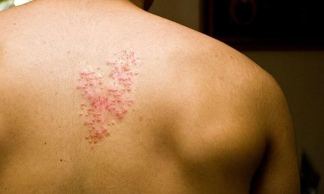 俗话说的“生蛇”是怎么回事？