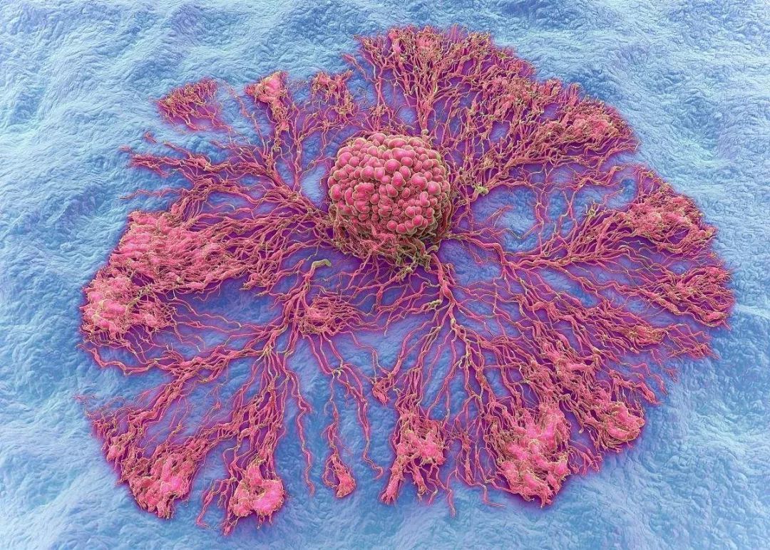 为什么年纪轻轻也会患癌？