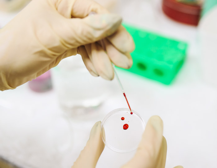 什么是基因筛查？与常规体检大不同