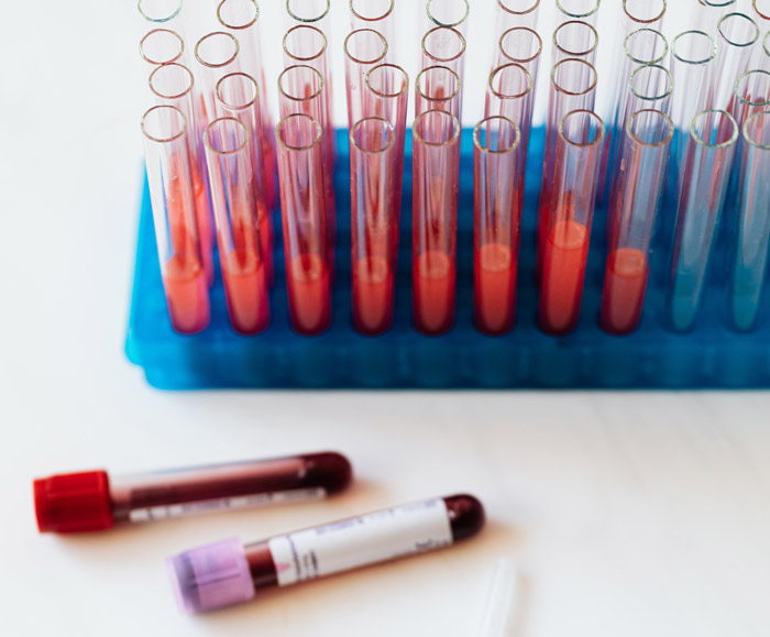 唐氏综合征有没有治愈的可能？