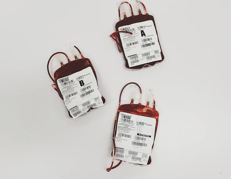 根据血型判断亲子关系准吗？