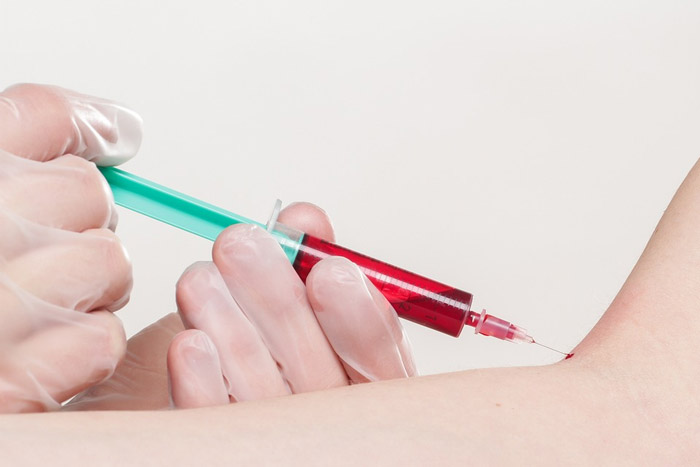 香港疫苗注射需注意哪些事项？这几件事要做好