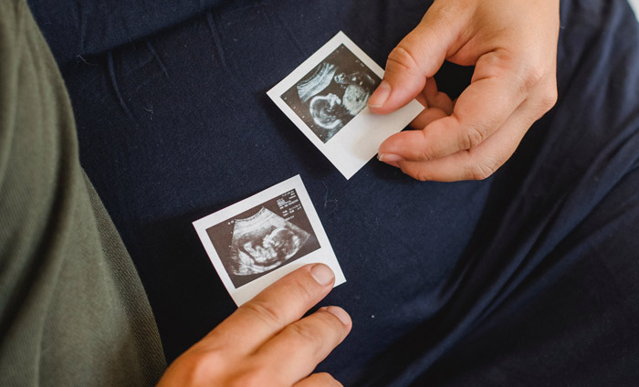 无创基因筛查几周做?