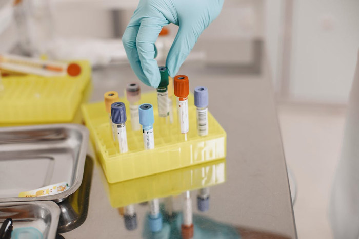 如何选择一家靠谱的基因检测机构?