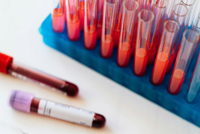 哪些人需要进行基因检测?