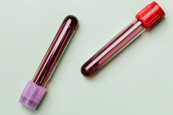 产前亲子鉴定有哪些方法?