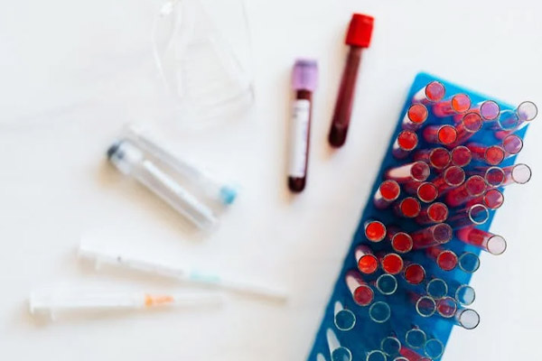 产前亲子鉴定报告有法律效力吗?