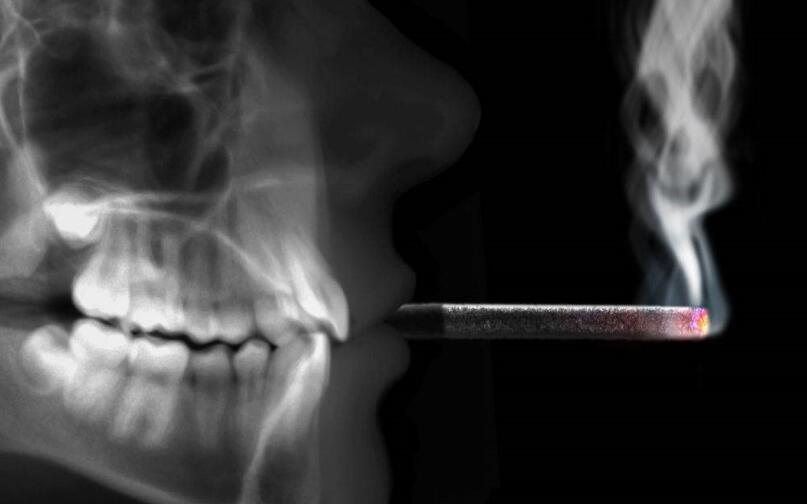 检查癌症的手段有哪些？