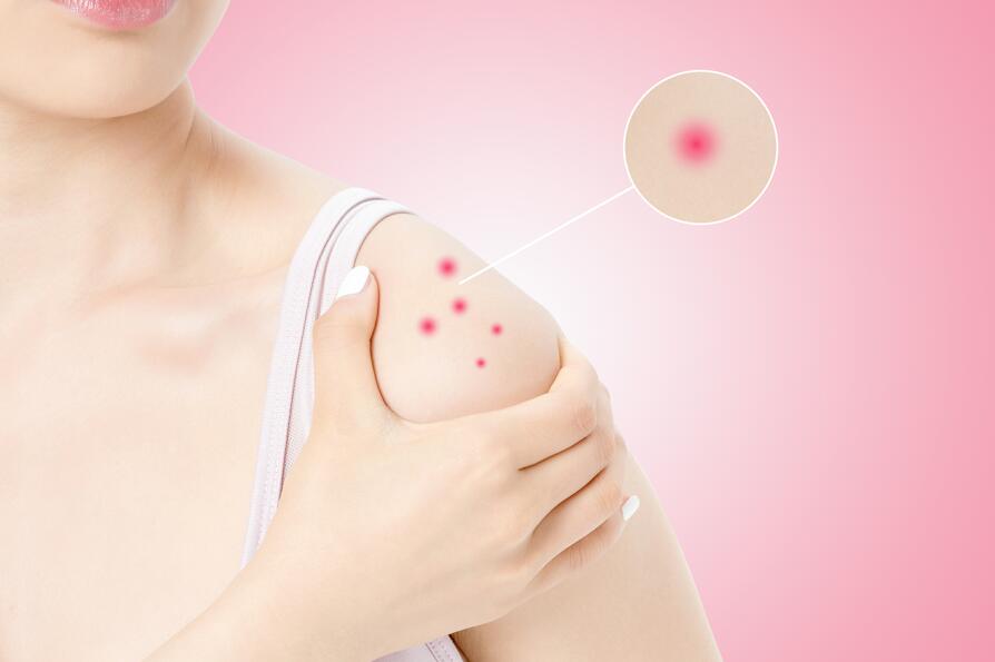 造成食物过敏的原因有哪些？