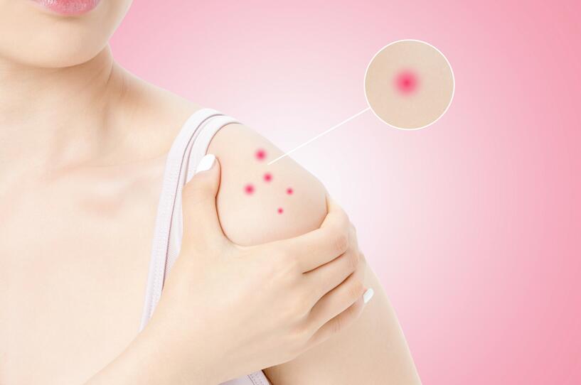 常见过敏性疾病有哪些？