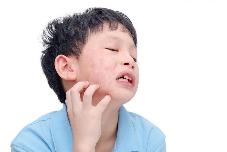 皮肤过敏痒又痛 免疫失衡怎么办？