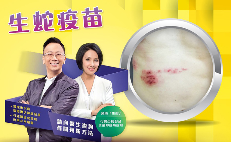 预防生蛇方法？你需要接种生蛇疫苗