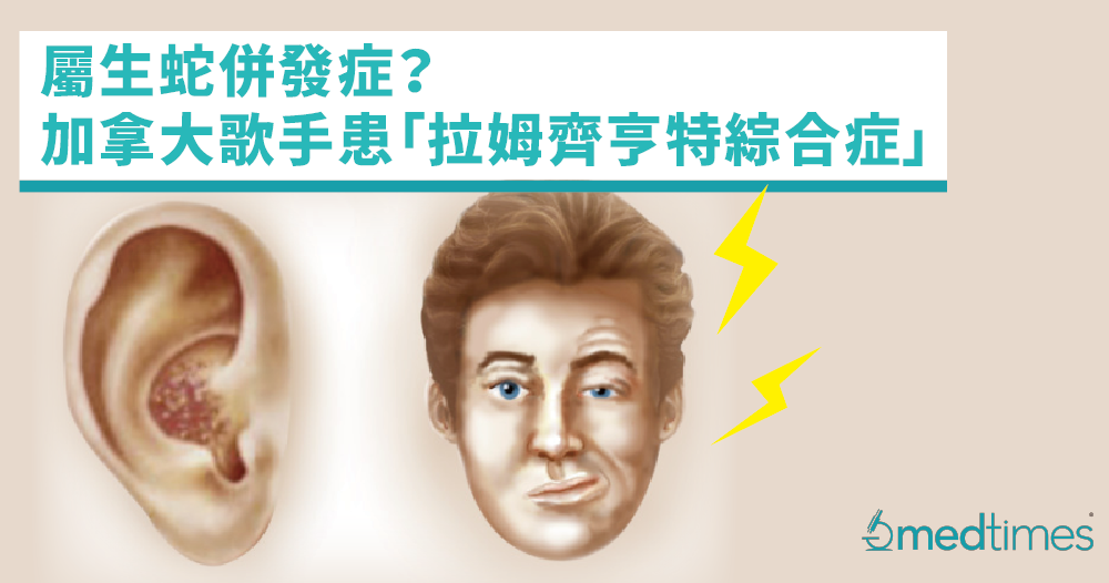 【带状疱疹】罕见病属生蛇并发症？加拿大歌手患「拉姆齐亨特综合症」致面瘫
